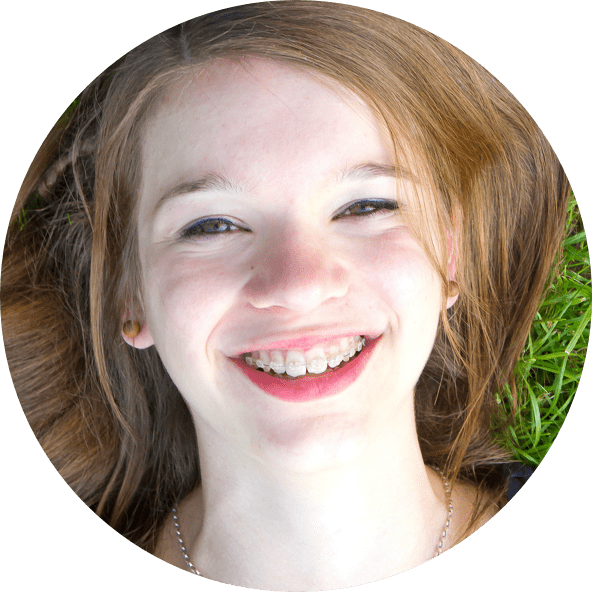 child smiling with braces