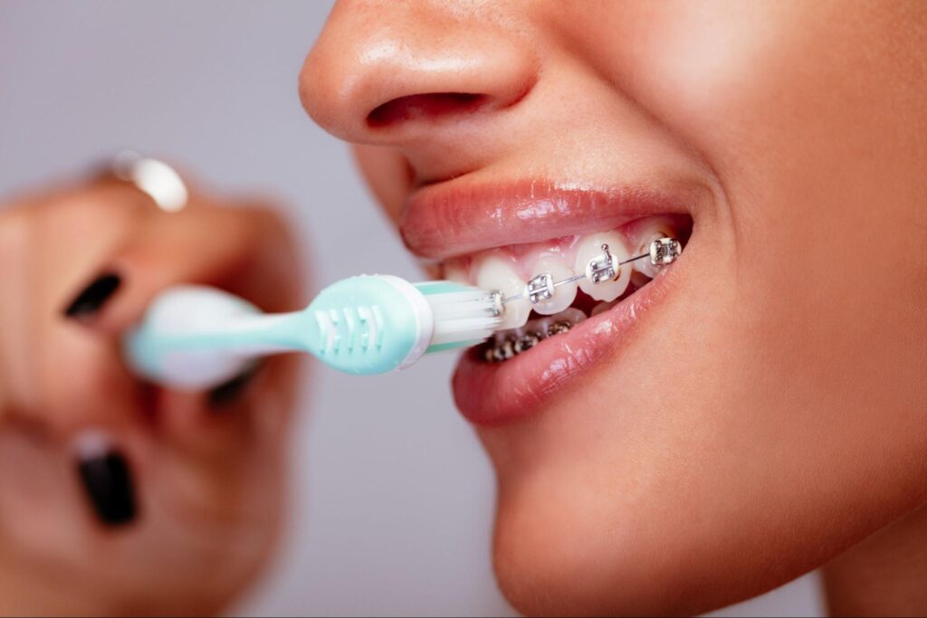 Oral Hygiene Tips After Indulging in Treats